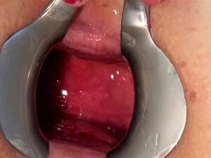 Extremes Anal-Dildo-Ficken mit Spekulum und anderen in der Muschi