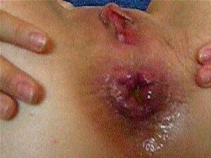 sperma op vieze kont