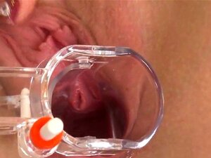 Сензулана мачкица шири ружичасту