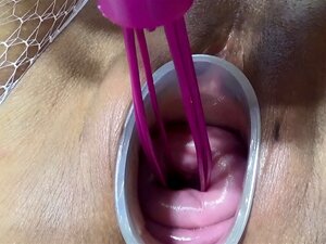 Reife Frau fickt Gebärmutterhals und dringt in die Gebärmutter ein