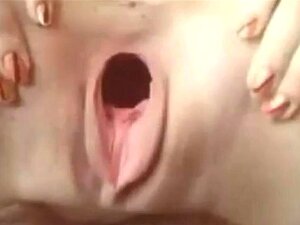 Сјајна рупа на овој девојци